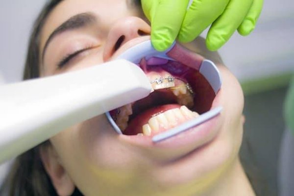 Innovations en prévention dentaire : les nouvelles technologies qui protègent votre sourire