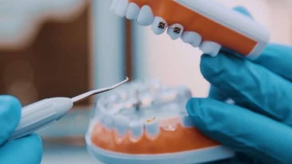10 Conseils Essentiels pour une Hygiène Bucco-Dentaire Parfaite en Célébration de la Journée Santé Bucco-Dentaire