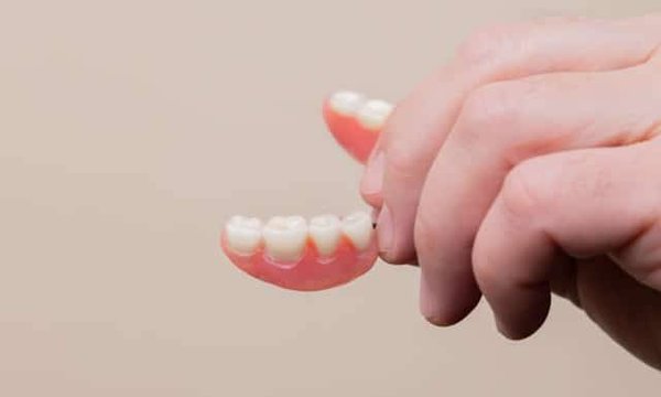 Combien de temps dure réellement un implant dentaire ?